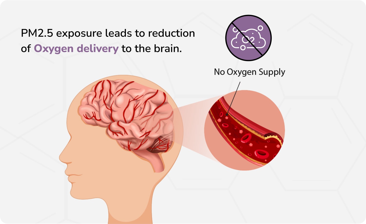 Air pollution affects the oxygen delivery to the brain that cause depression.